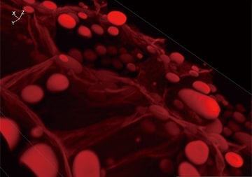 Sectioning observation