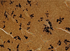 完全集中图像组成