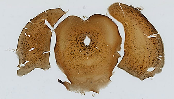 完全集中图像组成