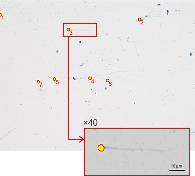 A.utomatic extraction of sperm head