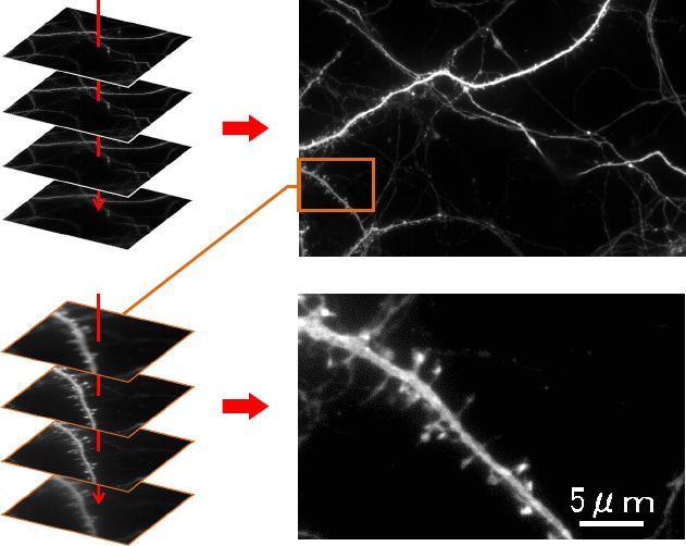 z叠加→厚度方向全聚焦