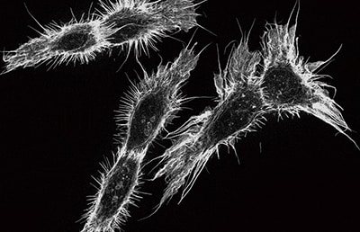 要对图像进行聚焦，请将镜头靠近样本，然后将其移离样本。