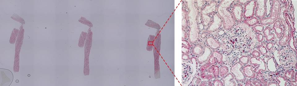 CD68(巨噬细胞)肾小球占用率分析例