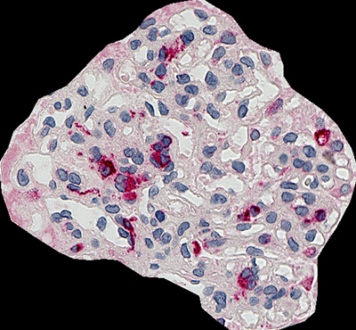 肾小球面积:23407 μm2