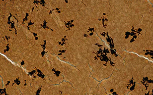 观察Golgi染色的大鼠脑神经组织
