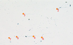通过圣诞树染色的精子检查