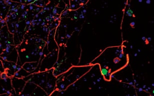 胚胎干细胞分化为神经系统细胞