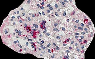 CD68（巨噬细胞）肾小球占用率的自动分析
