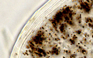 头发横截面皮质观察和角质层层层评价