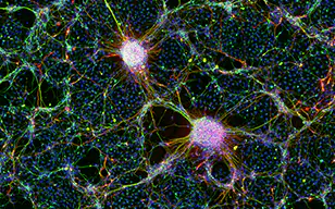 人类iPS细胞来源的神经细胞