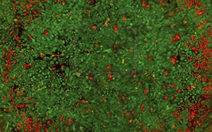 角质形成细胞生长潜力