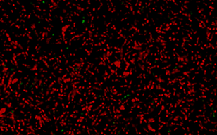 微生物直播/死导