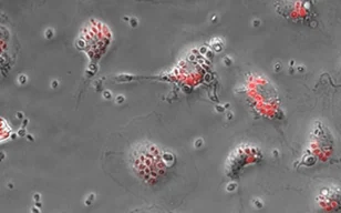 可视化吞噬活性（微胶质细胞吞噬细胞珠子）