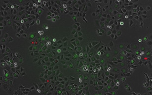 使用FUCCI的口腔衍生上皮细胞系（CA 9-22）的细胞周期观察