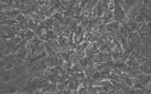 使用直接重编程诱导心肌细胞（ICM细胞）