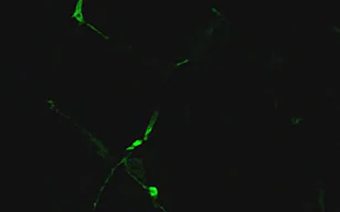 神经祖细胞的轴突伸长（PC12）