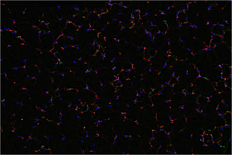 这张照片是用雾霾减少功能锐化的。骨髓细胞和血管清晰可见。
