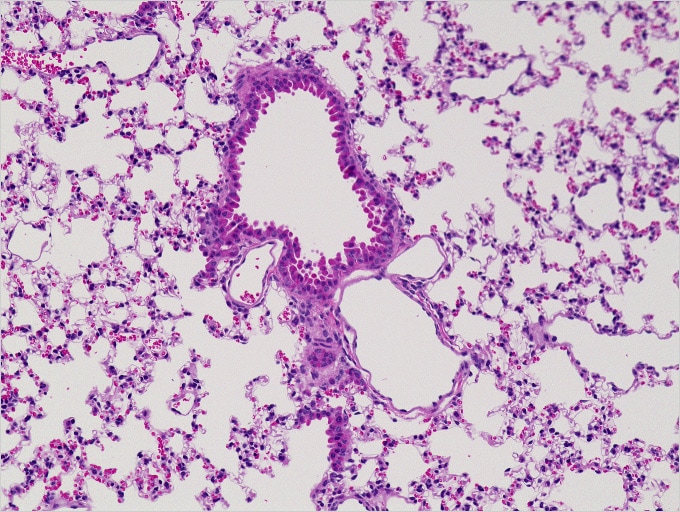 图片:正常小鼠肺(H&E染色)…