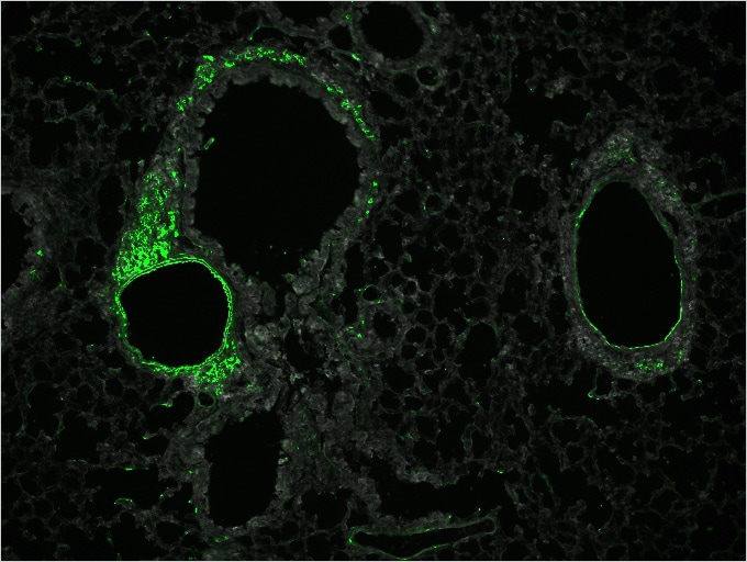 图像:有哮喘症状的肺，免疫荧光染色…