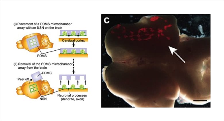 图:植入(转录)人工神经网络…