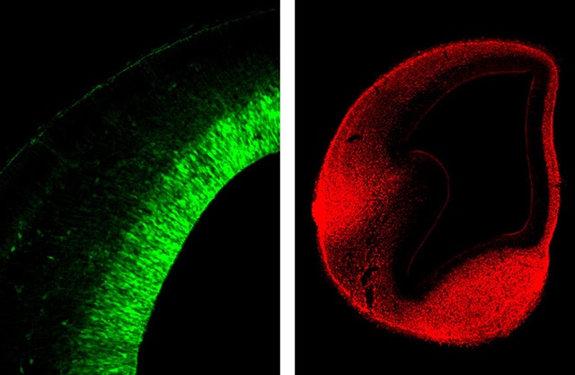 图片:左边的照片描绘了神经干细胞，神经系统的基础…