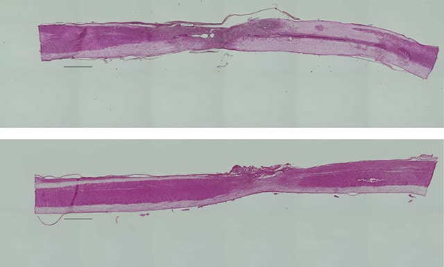 图片:上面的图描绘了一个纤维母细胞移植到受损的脊髓上。