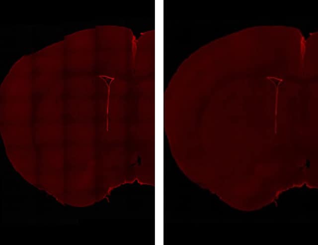 图片:成年小鼠室管膜细胞染色图。